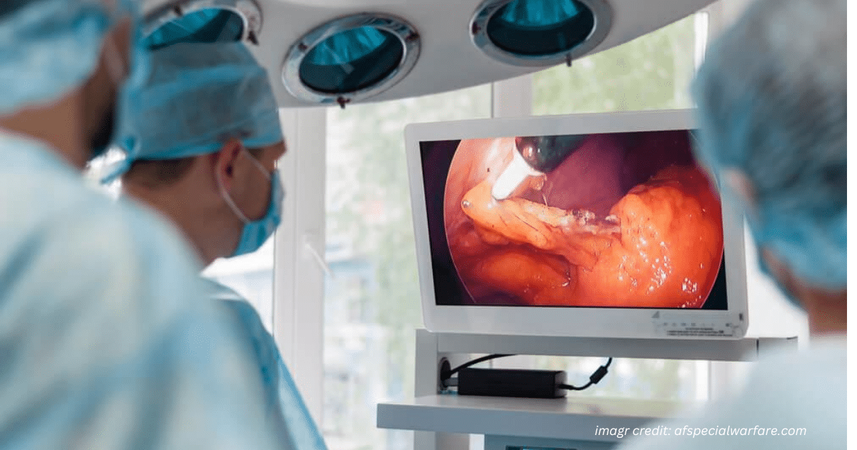 Endoscopic Sclerotherapy Shines as Treatment for Anastomotic Tumor