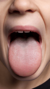 A 7-year-old male with pallor and abdominal discomfort