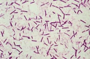 A middle-aged man with abdominal pain after consuming canned food
