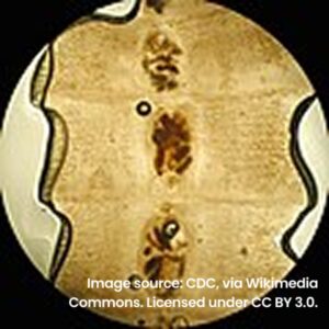 A middle-aged man with abdominal pain and fatigue
