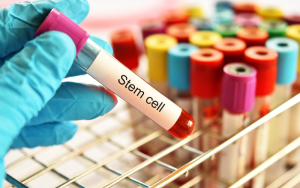 Dissecting Complex Disease Genetics via eQTLs in Stimulated iPSC-Derived Macrophages