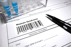 Multidisciplinary Consensus Guidelines for Lifelong Care in Patients with Noonan Syndrome