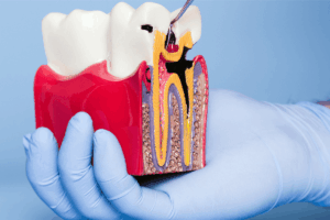 From Erosion to Restoration: The ELR-Matrix Regenerates Human Enamel Structure and Function