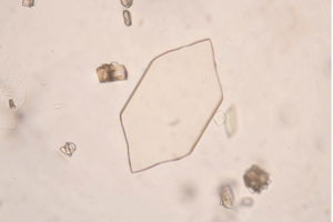 The Hidden Power of Uric Acid Nanocrystals in Reptiles