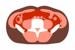 Hidden Conversations: How Fat Tissue Around the Colon Talks to the Immune System