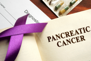 Understanding Malpractice in Pancreatic Cancer: A 10-Year National Analysis from Norway